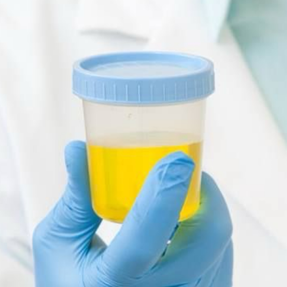 RAPID/ LAB TESTED (BY MRO) at Precision skin and Wellness Lab in Tallahassee, FL