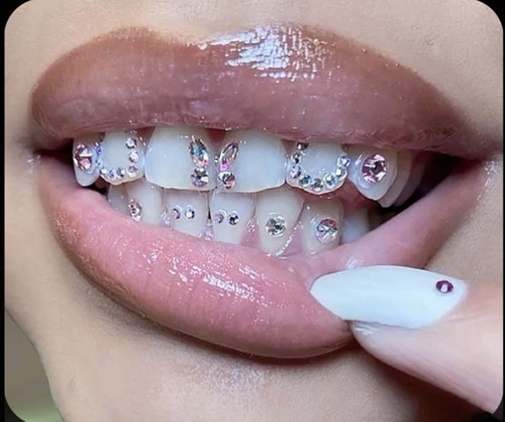 Tooth Gems