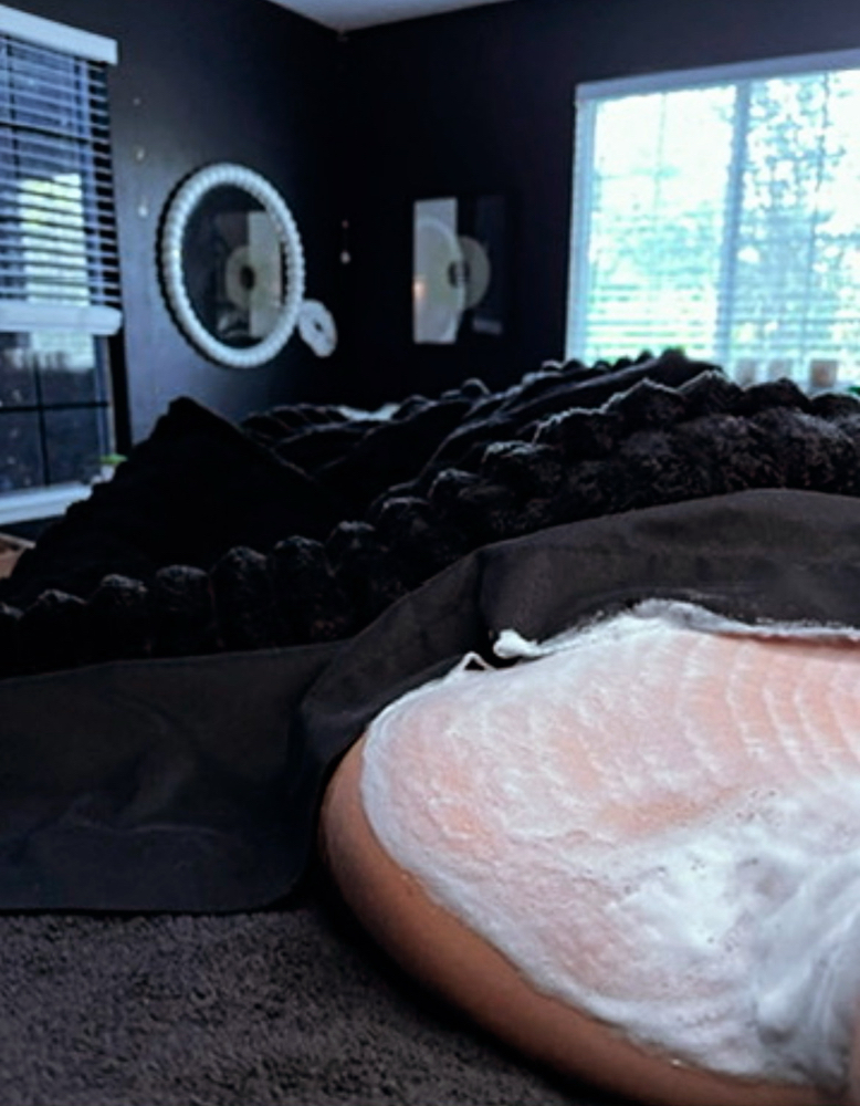 ACNE FACIAL + #usedtobecool