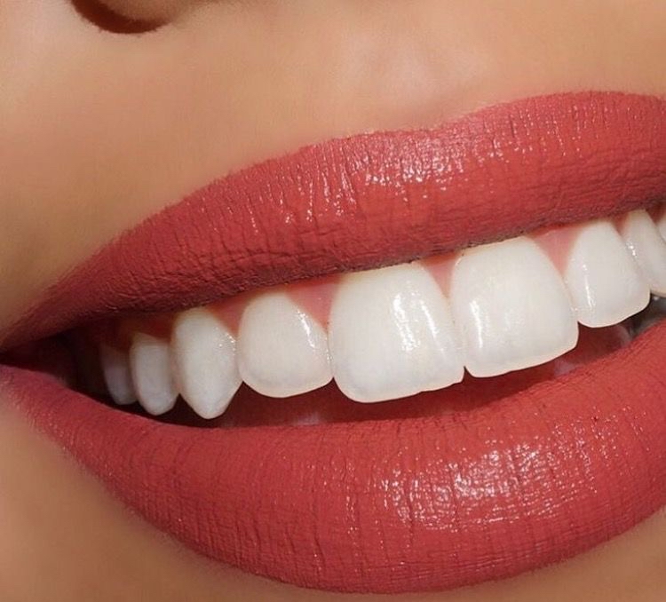Teeth Whitening - Sensitive Teeth**