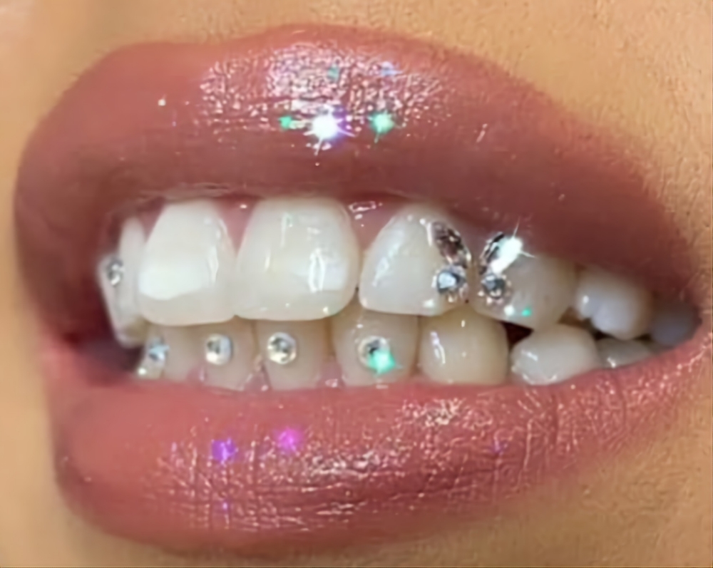 Tooth Gems