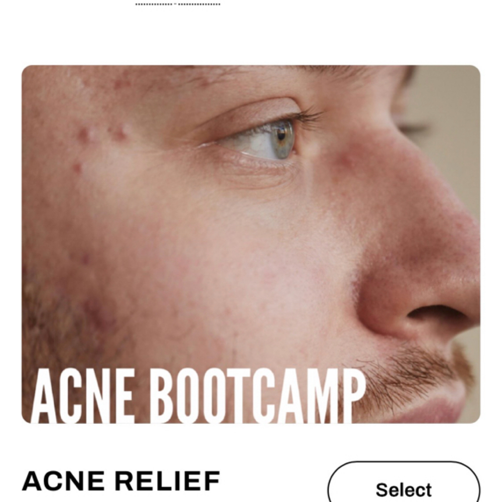 ACNE RELIEF BOOTCAMP at AESTHETICSBYNATALY in Alhambra, CA