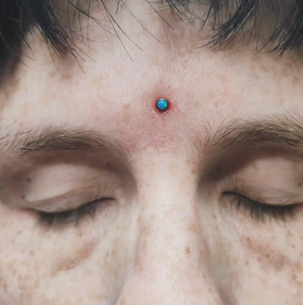 Dermal