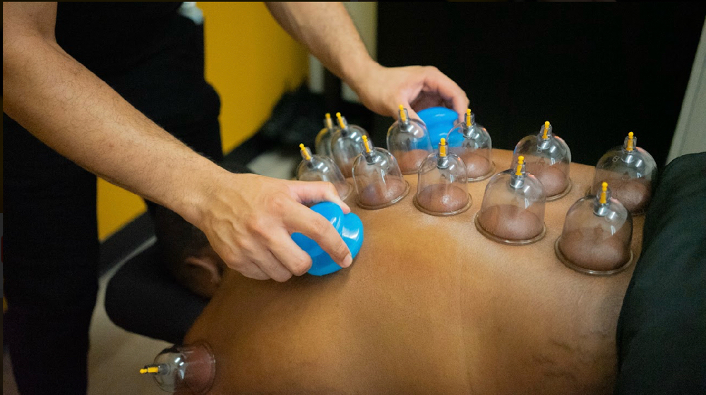 Add-On Cupping Therapy