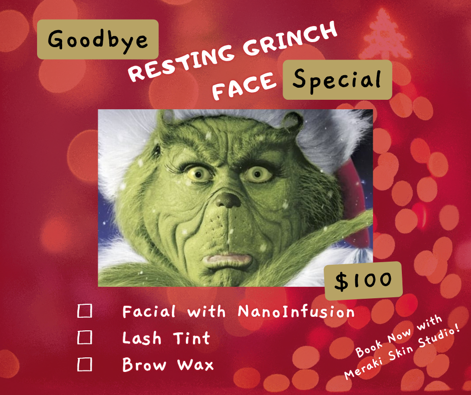 Goodbye Grinch Special 🎄