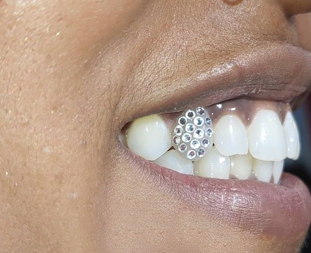 Tooth Gems- Full Tooth Bling (Icy)