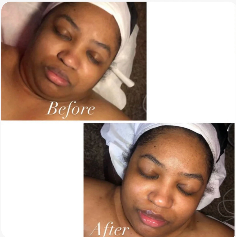 SIGNATURE FACIAL #2 (2 ADD ON'S)