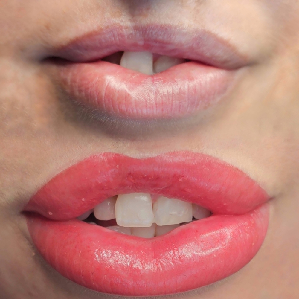 Restoration Lip Blushing