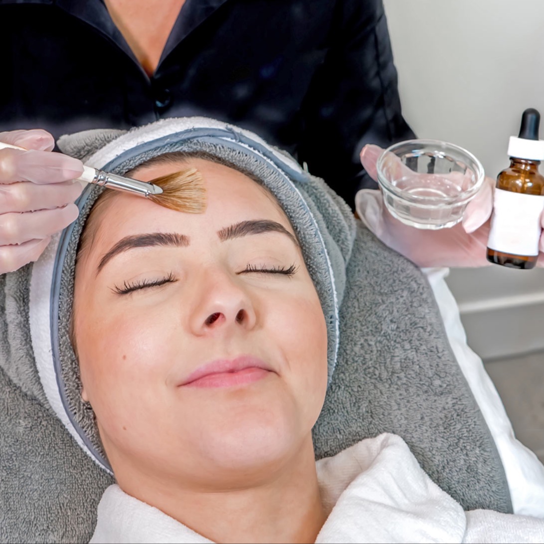 AFA Chemical Peel