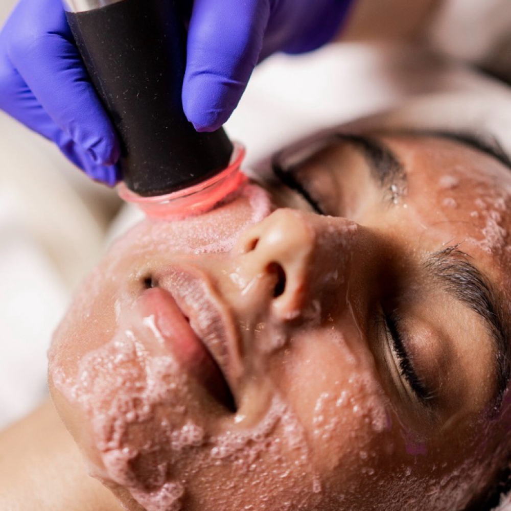 Oxygen Treatment at Alpine Glow Aesthetics, LLC in Colorado Springs, CO