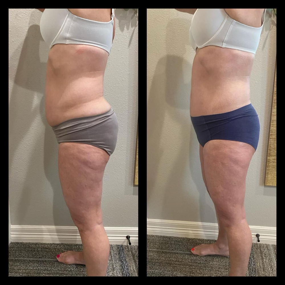 Total Body Sculpting