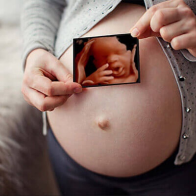 HD Live Ultrasound 5D at Whittier 3D 4D Ultrasound by 4D Special Delivery in Whittier, CA