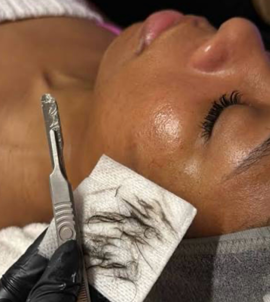 Add On Dermaplane