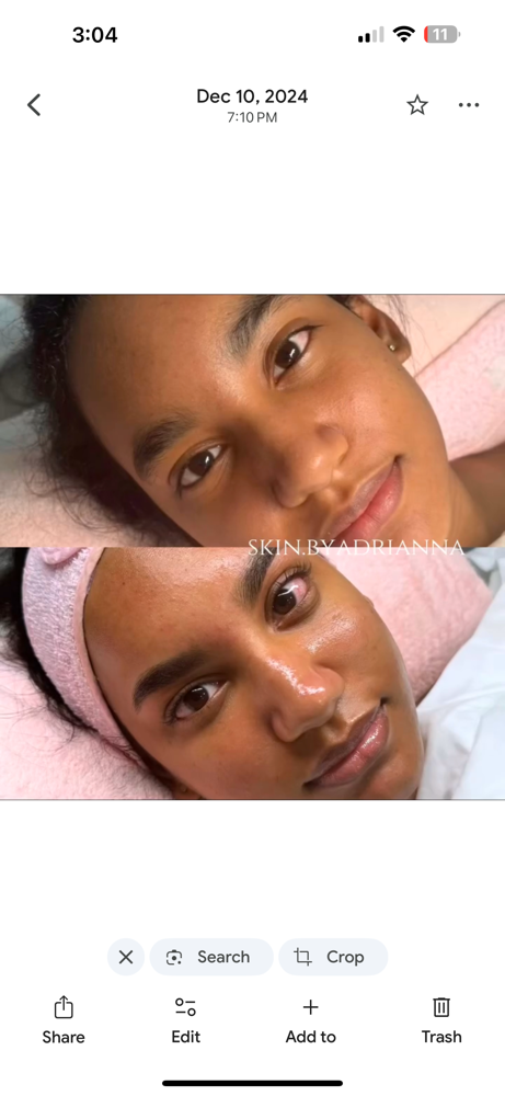 Brightening Facial