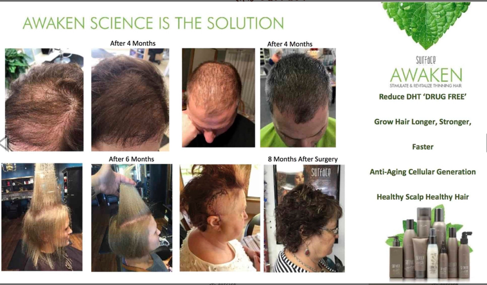 Surface Awaken Scalp Facial at HAIRXVILMA in La Vista, NE