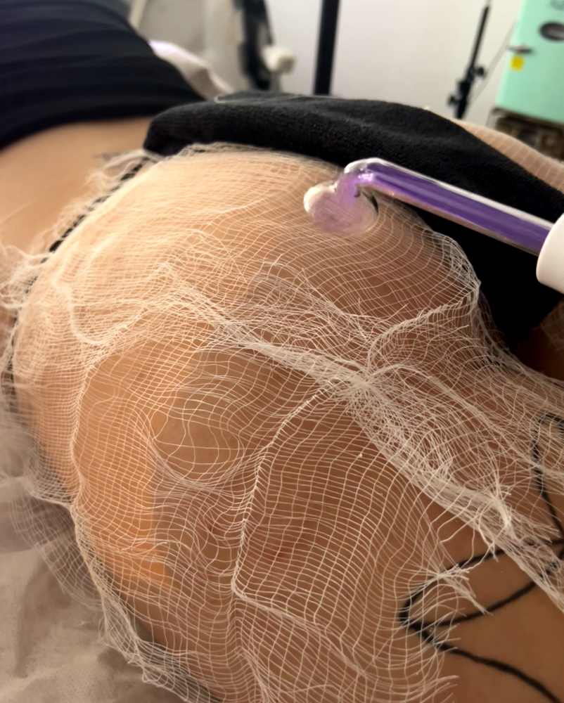 Butt Facial 🫧