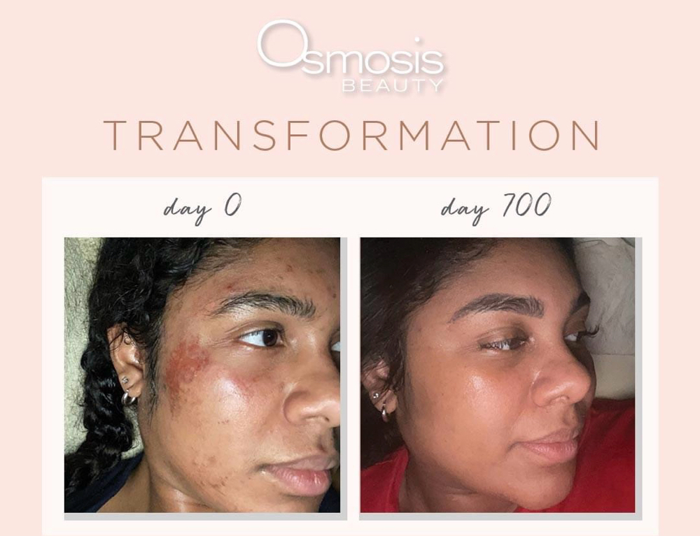 Osmosis Uneven Skintone Facial