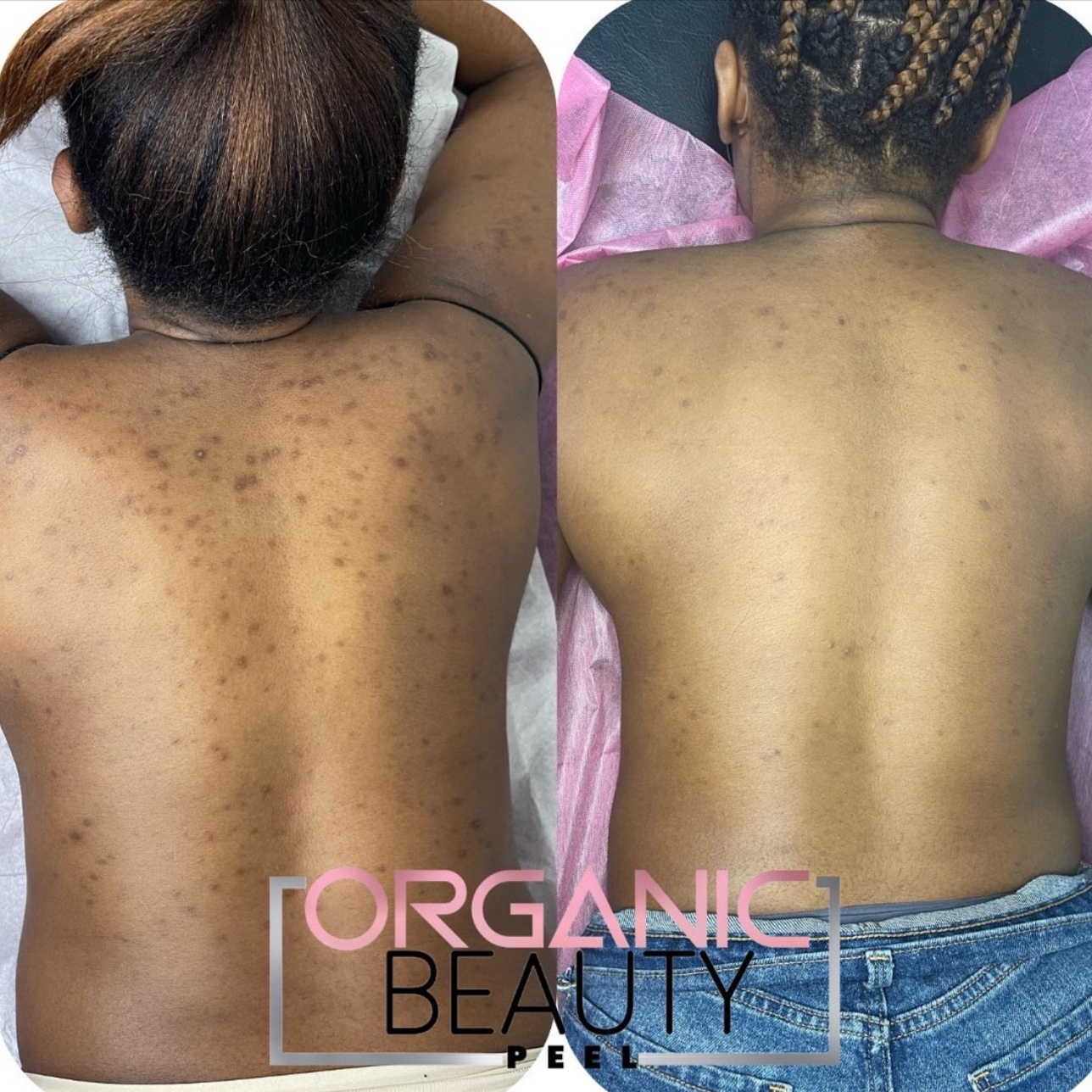 Organic Beauty Peel – Body + Face