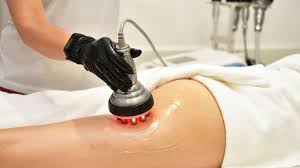 Body Contouring Treatment