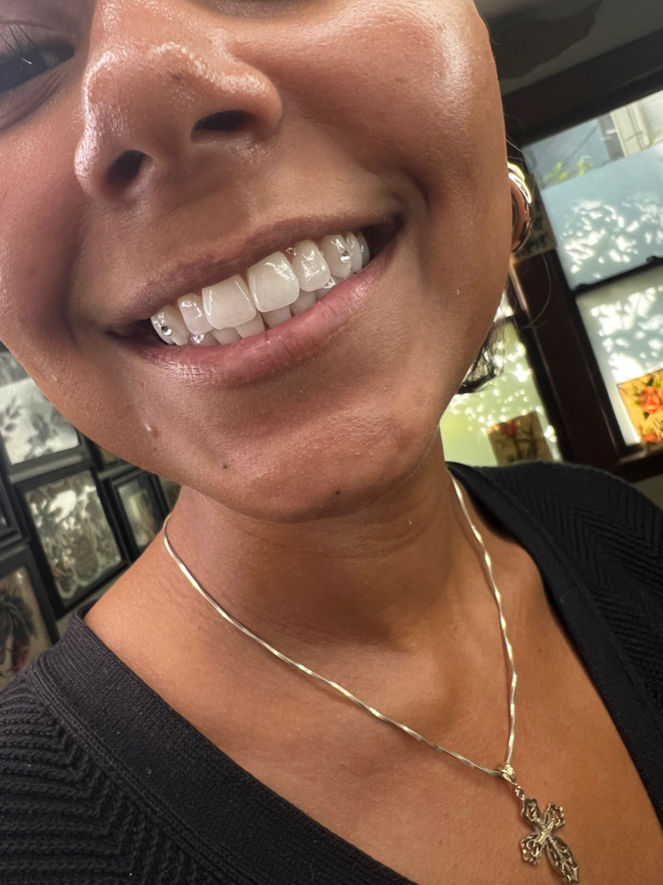 Tooth Gems