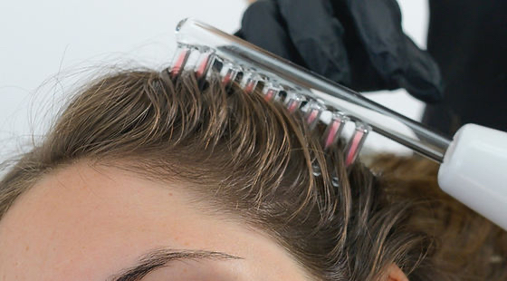 High Frequency On Scalp