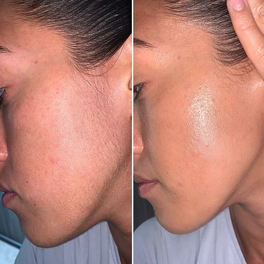 Face Waxing