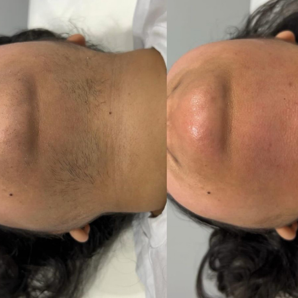 Chin at Charismatic Beauty in Apple Valley, CA