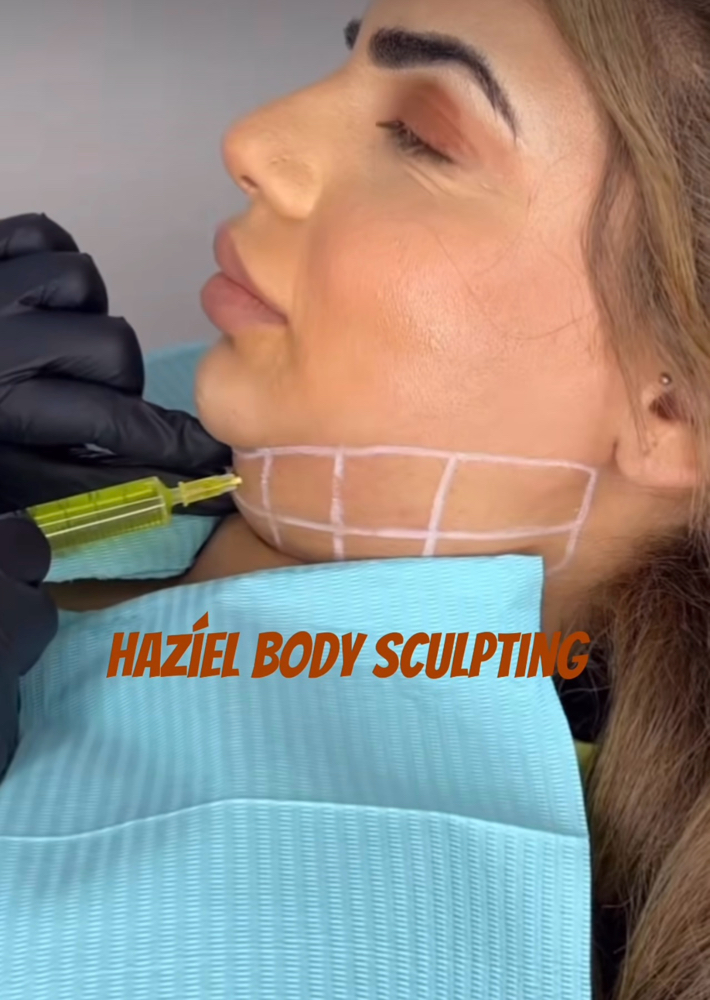 Lipolysis under chin / Papada