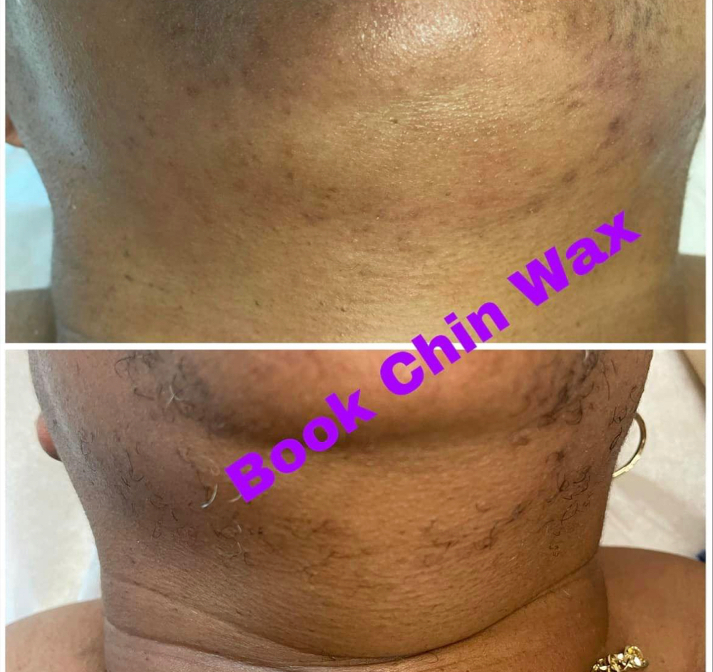 Chin Wax