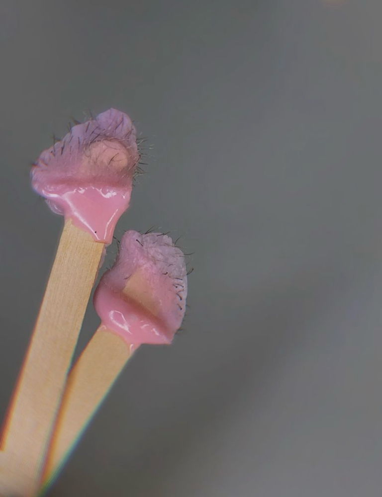 EAR WAX at Kay The Esthi in Prescott Valley, AZ