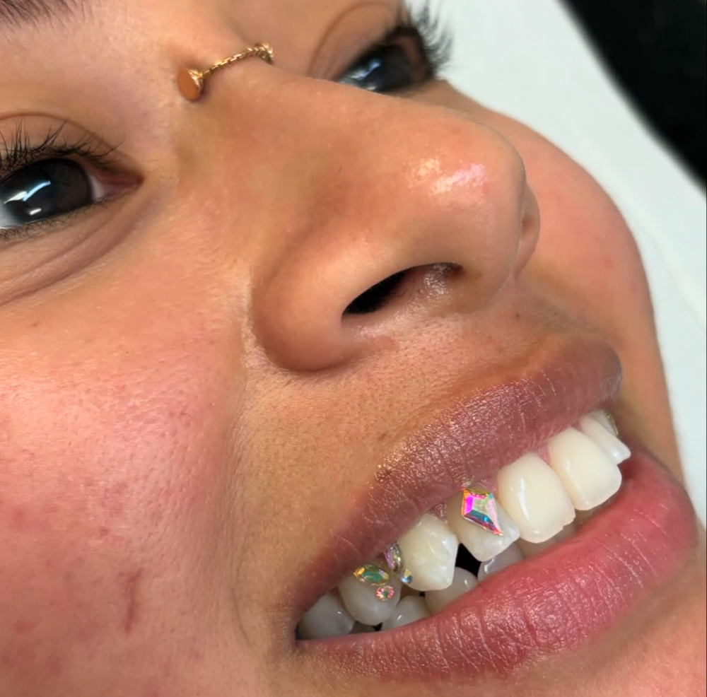 Tooth Gems