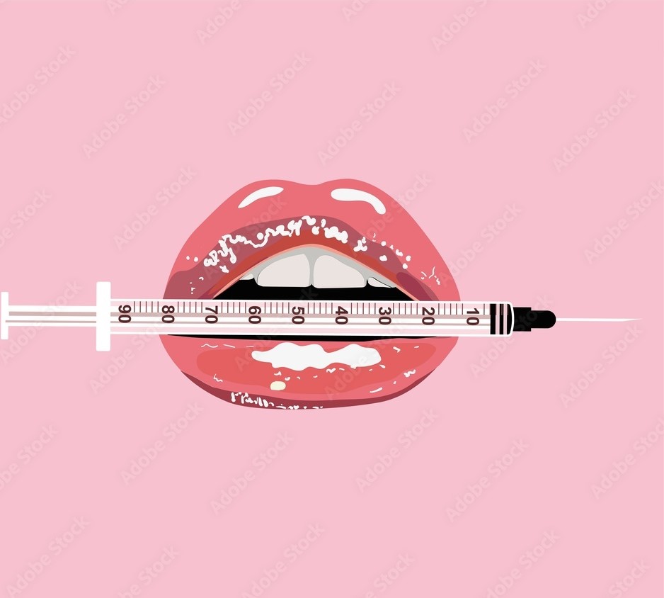 Full Syringe Lip Filler