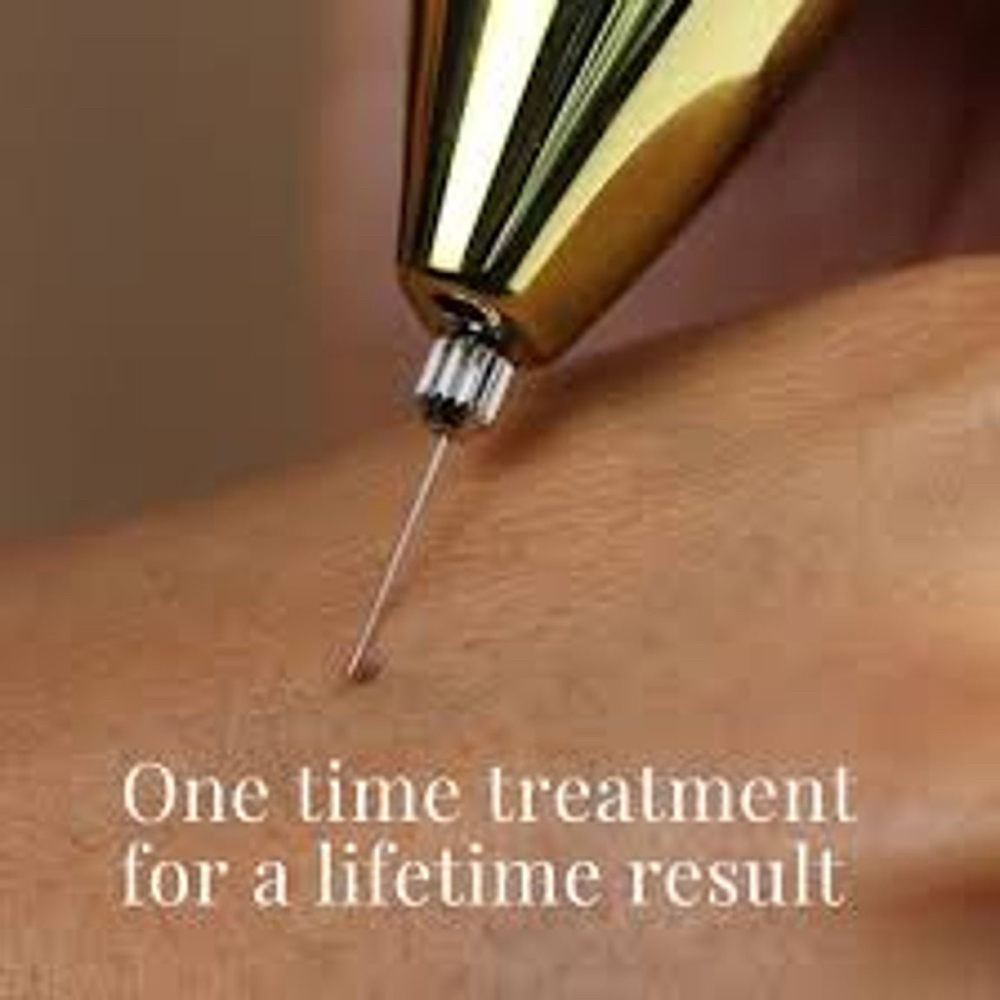 Skin Tag Removal at Revive Wellness in El Paso, TX