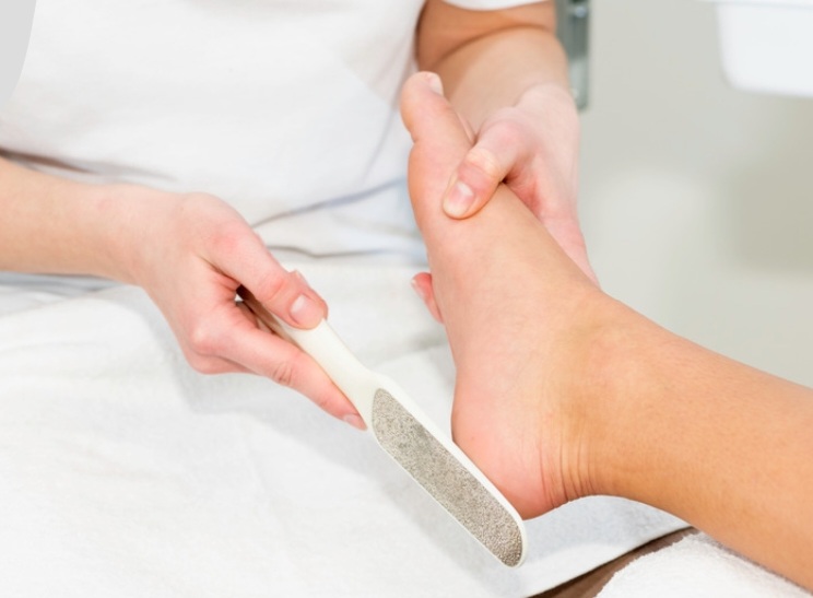 Add On Callus Remover