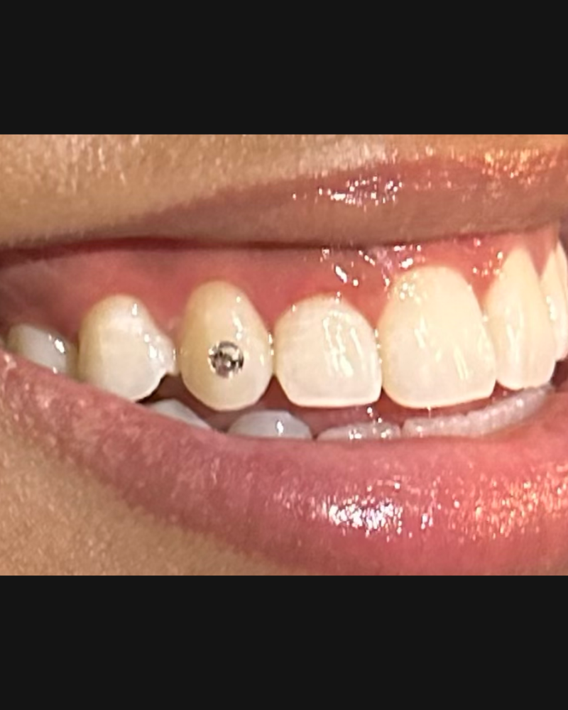 Tooth Crystal