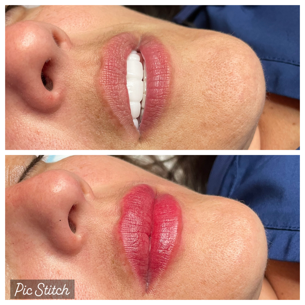 Lip Blushing