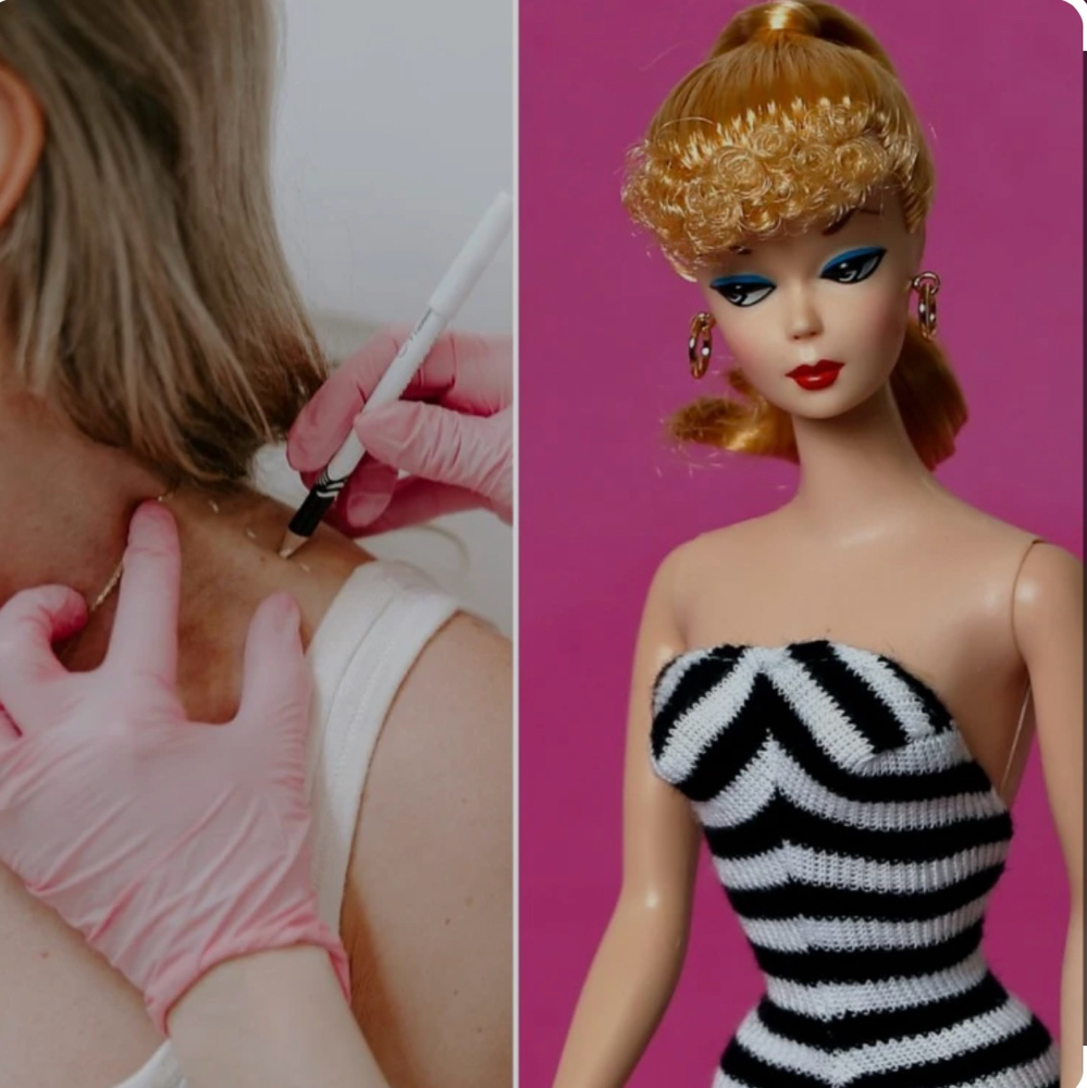 Barbie Botox