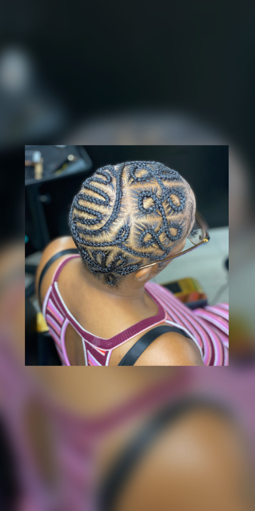 Baldie Braids
