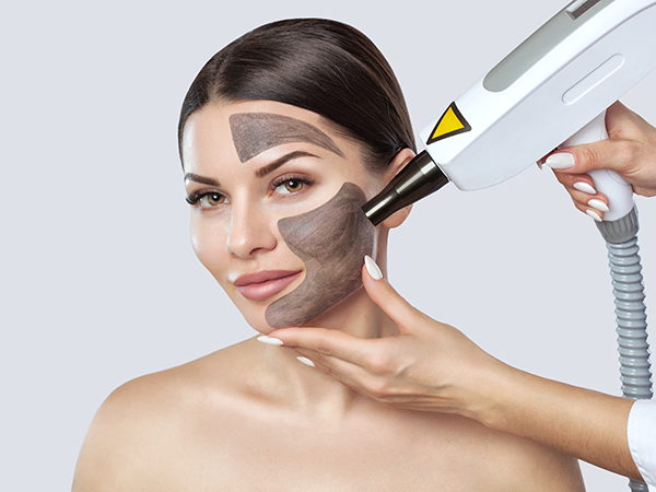 Carbon Peel Facial