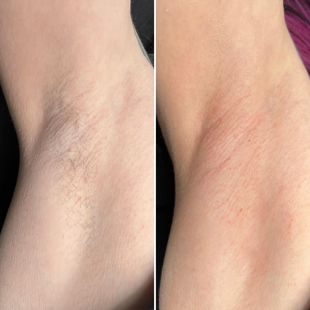 Body Waxing