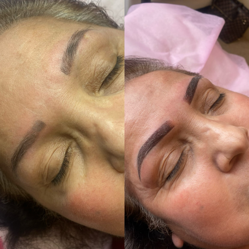 Brow Correction Not My Work