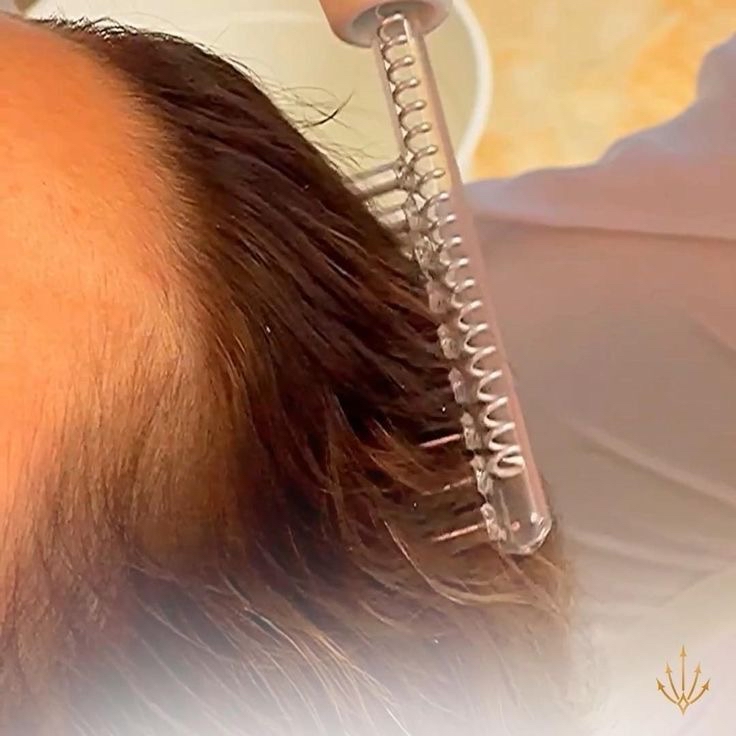 Scalp Treatment