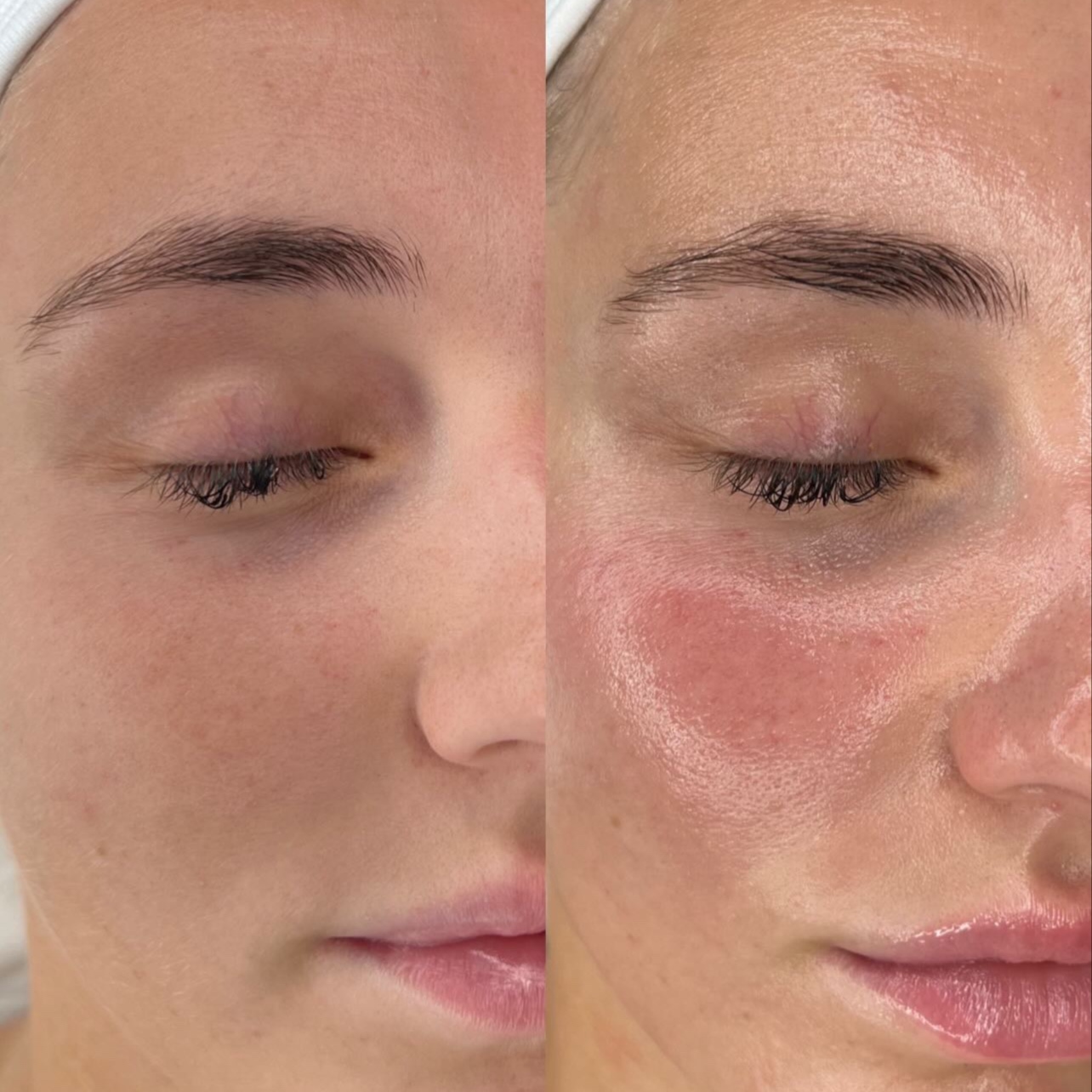 Alginate Mask at Embassy&health&beauty in Hallandale, FL