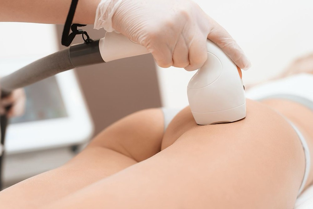 Buttocks Laser Hair Removal (single