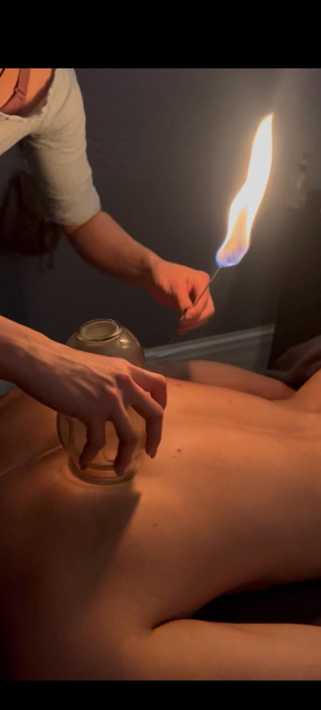 Fire Cupping (60min)