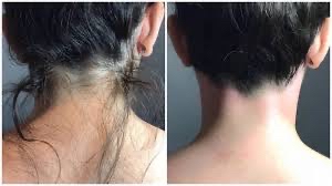 Neck