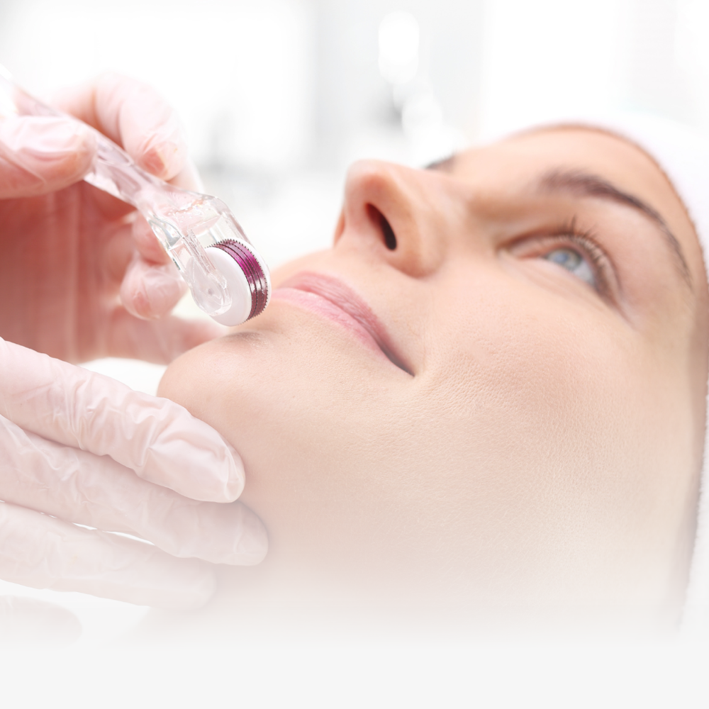 Microneedling With Stem Cell Serum