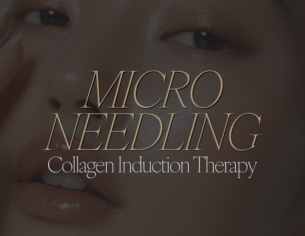 Microneedling
