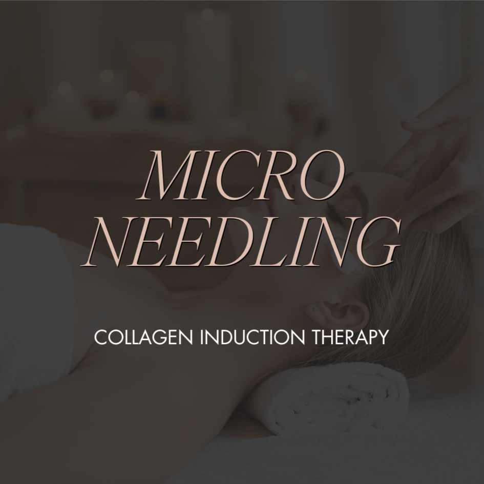 Microneedling