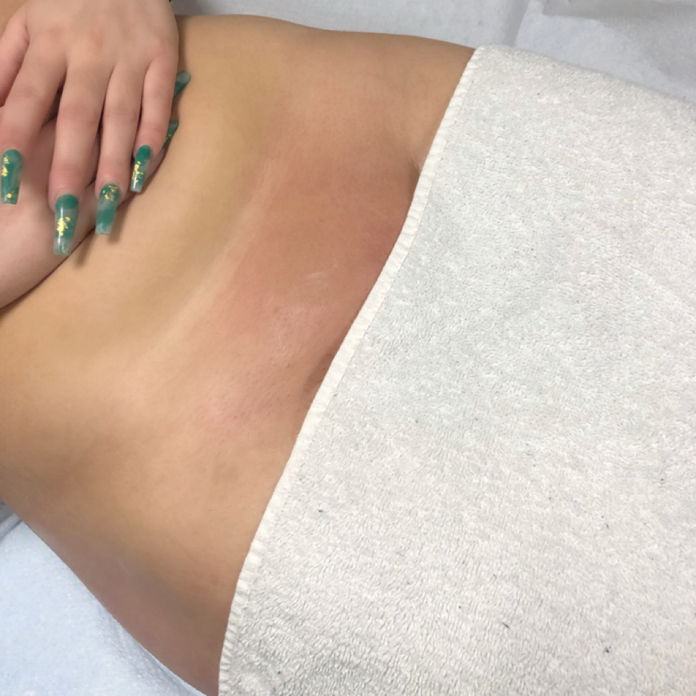 Brazilian Wax at Azure Beauty in Syracuse, NY